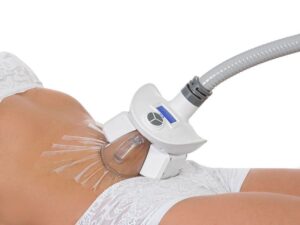 Cryolipolyse